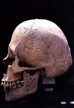 Рисунок 1. Плоская вертикальная черепная деформация, достигнутая при использовании дощечек: Шкарет, Кинтана-Роо, Мексика; классический период.